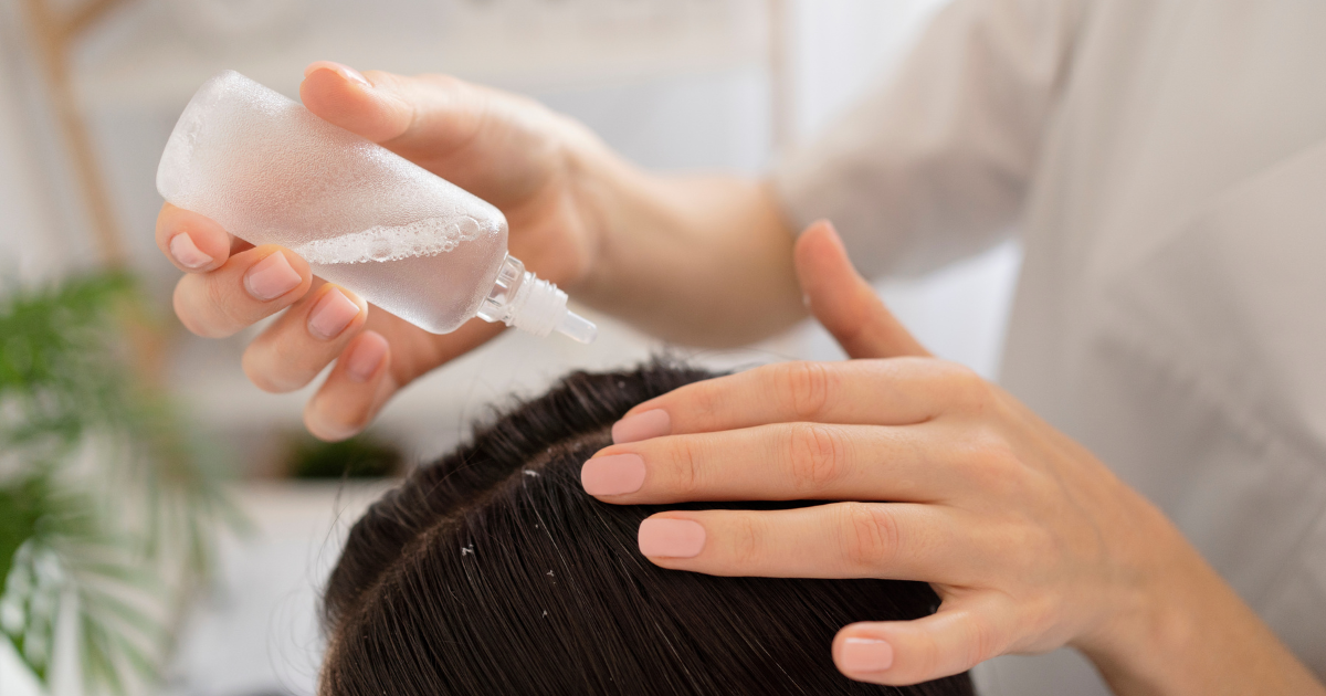 Trị gàu mùa đông: Bí quyết giữ tóc và da đầu khỏe mạnh