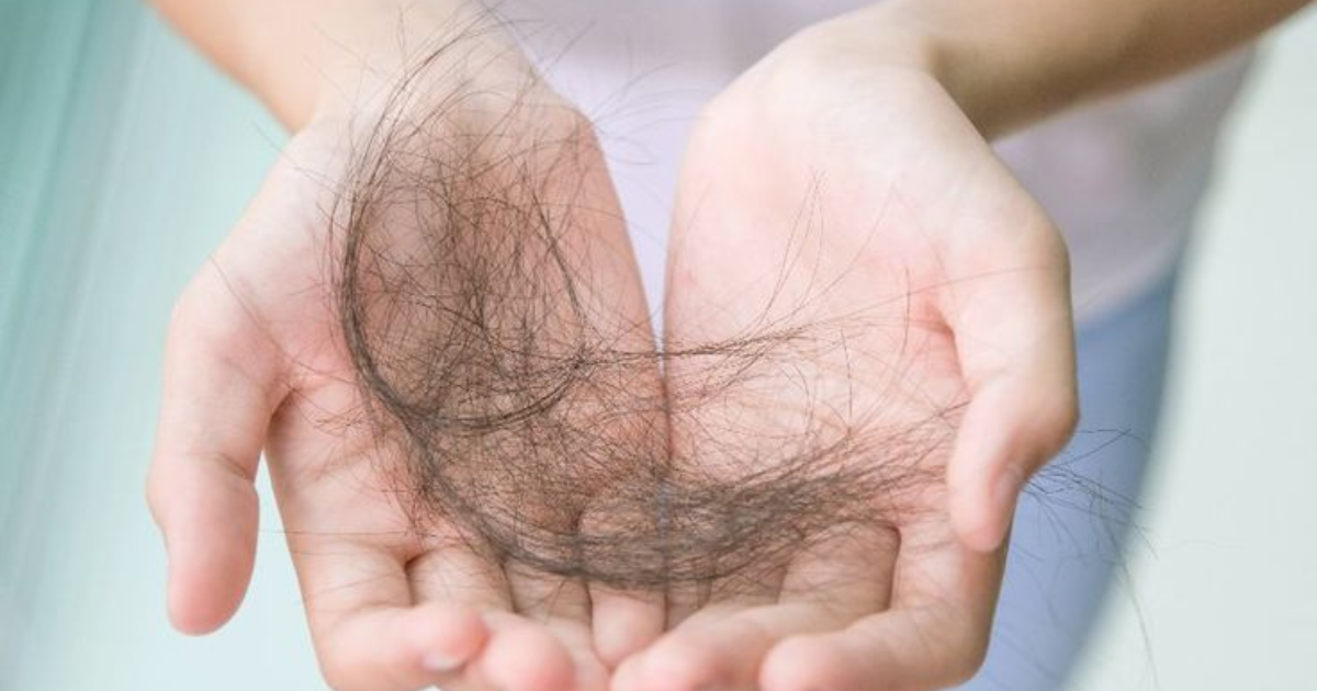 Tóc rụng nhiều? Khi nào là bình thường, khi nào cần đi khám?