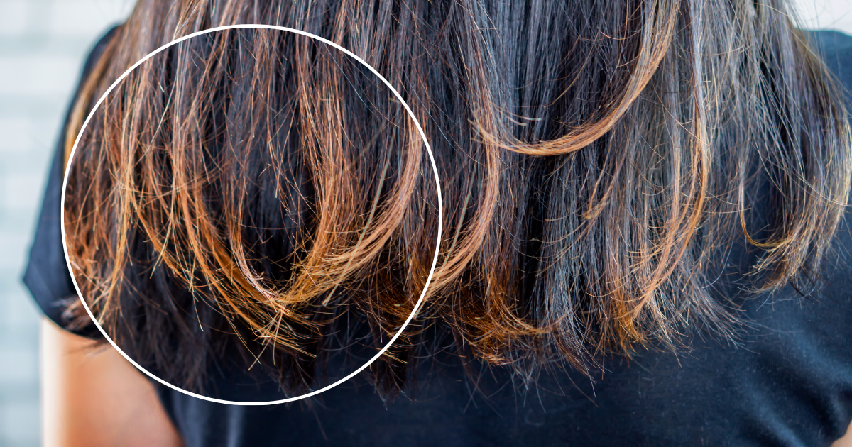 Tóc chẻ ngọn có phục hồi được không? Nguyên nhân & giải pháp hiệu quả