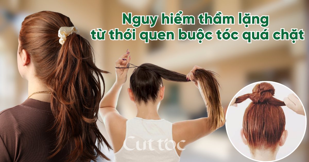 Nguy hiểm thầm lặng từ thói quen buộc tóc quá chặt mà ít ai biết