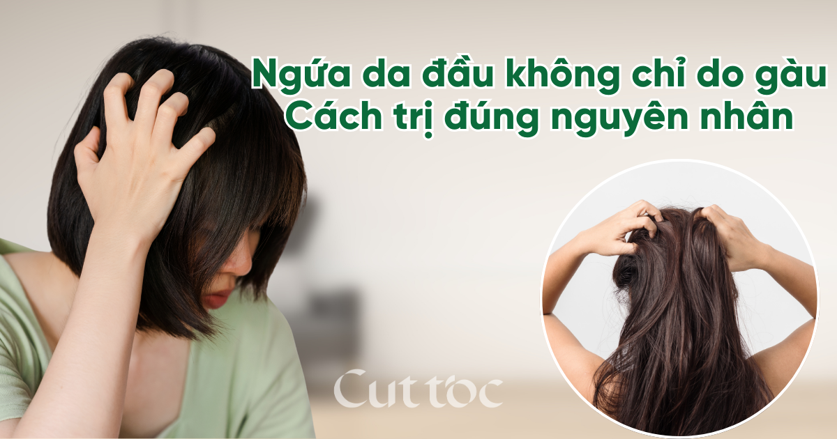 Ngứa da đầu không chỉ do gàu: Cách trị ngứa da đầu đúng nguyên nhân